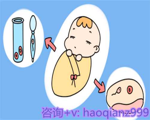 广州试管四代是怎样的,广州试管助孕价格多少