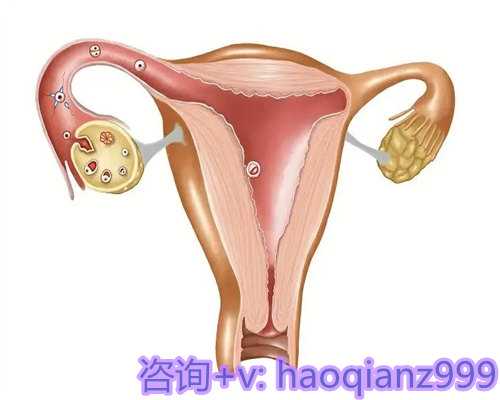 武汉试管助孕保险，2019年武汉新生儿医保政策