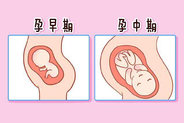 孕妇房间可以放吊兰吗？答案是否定的。首先，我们要了解吊兰对孕妇的影响。