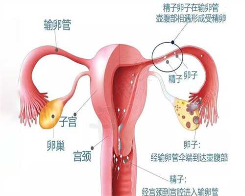 广州供卵试管婴儿如何才捐卵代孕能找到卵妹