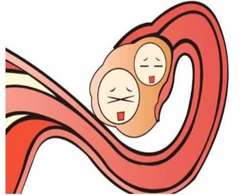 高校捐卵群_卵巢囊肿会影响怀孕如何及时治疗，