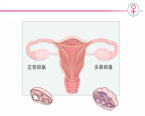 地下捐卵_美国找捐卵_武汉导致女性不孕的卵巢性