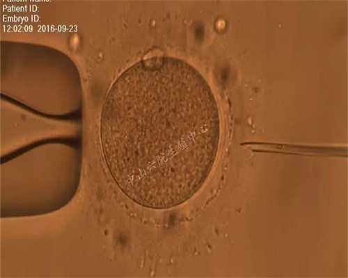 天津捐卵的经历,盘点诱发女性卵巢性不孕的原因