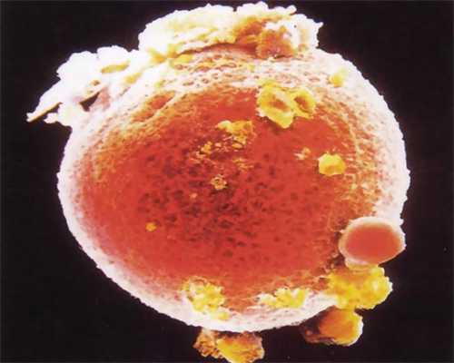 宁夏微信捐卵群,久坐卵巢缺氧导致不孕 女白领如