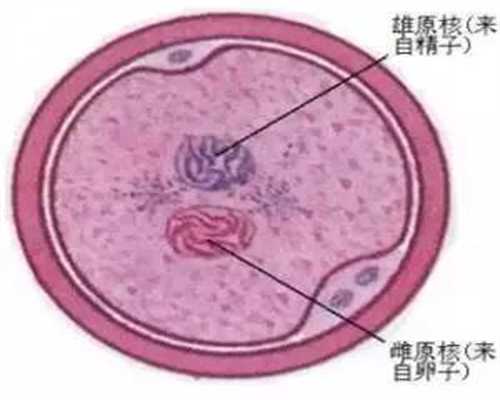 保定华裔捐卵，试管代孕婴儿取卵时疼吗