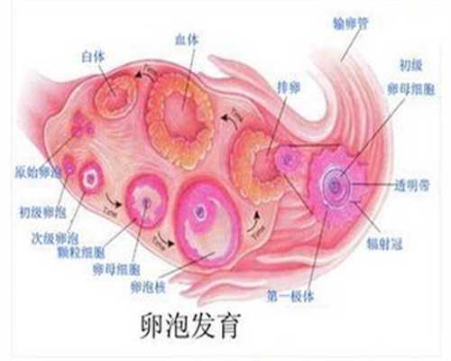 上海不孕捐卵，什么是多卵泡卵巢 多卵泡卵巢怎么治疗