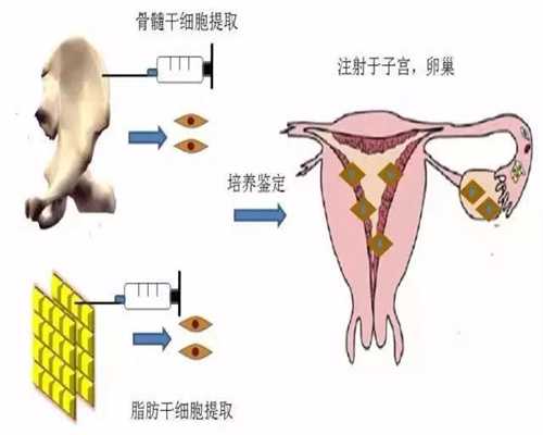 湛江中国可以捐卵-广州供卵试管试管婴儿真实经历步骤麻烦吗？