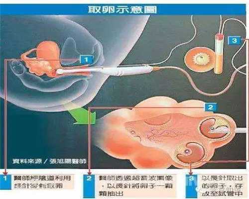 株洲中国正规捐卵，做试管婴儿是否是越年青越好？？卵巢早衰供卵成功率高吗