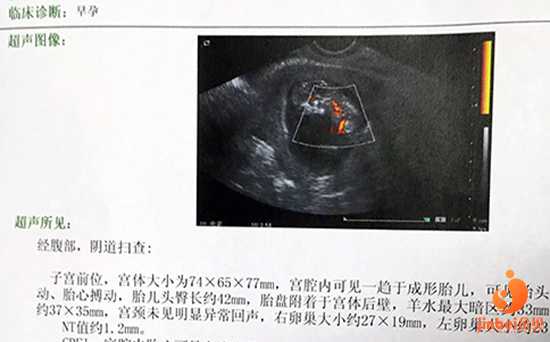 广州供卵试管公司联系电话，卵巢早衰供卵成功率高吗